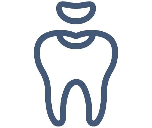 Liverpool dental fillings