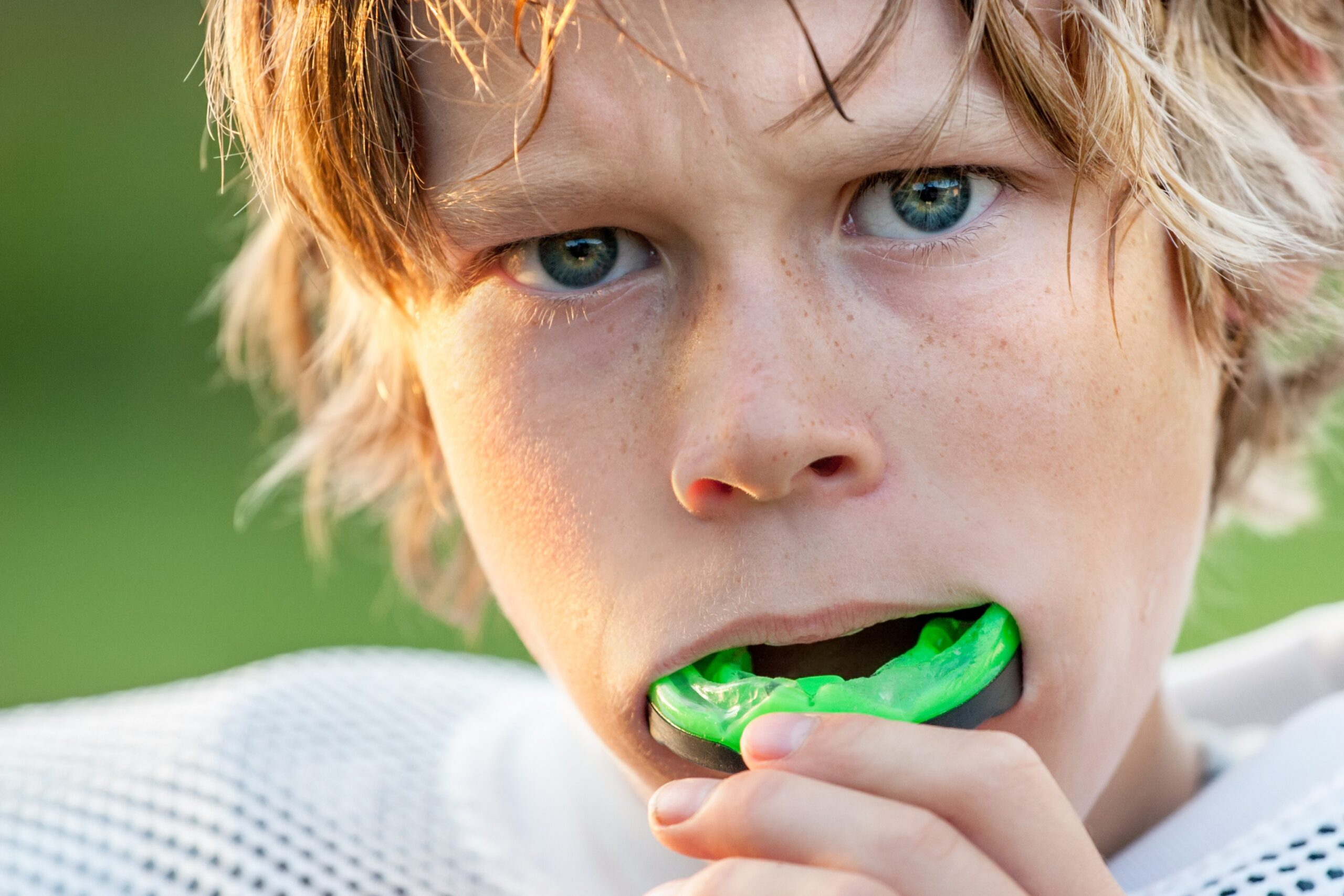 Mouthguards by beautiful smile dental surgery in Merrylands